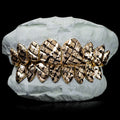 10 Gold Teeth: 10-22K Tops or Bottoms image 3