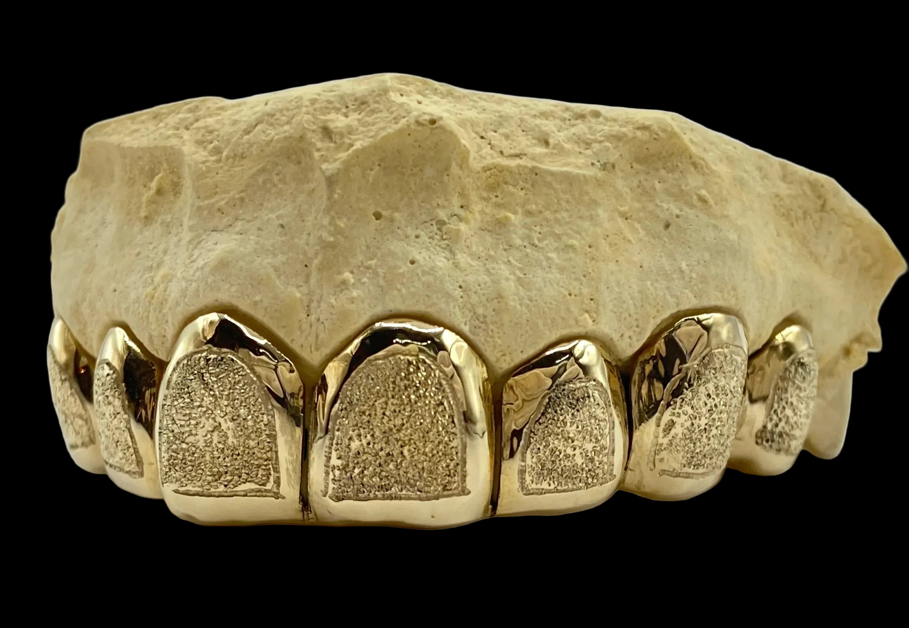 8 Gold Teeth: 10k Yellow Gold 8 Piece With Diamond Dust image 2