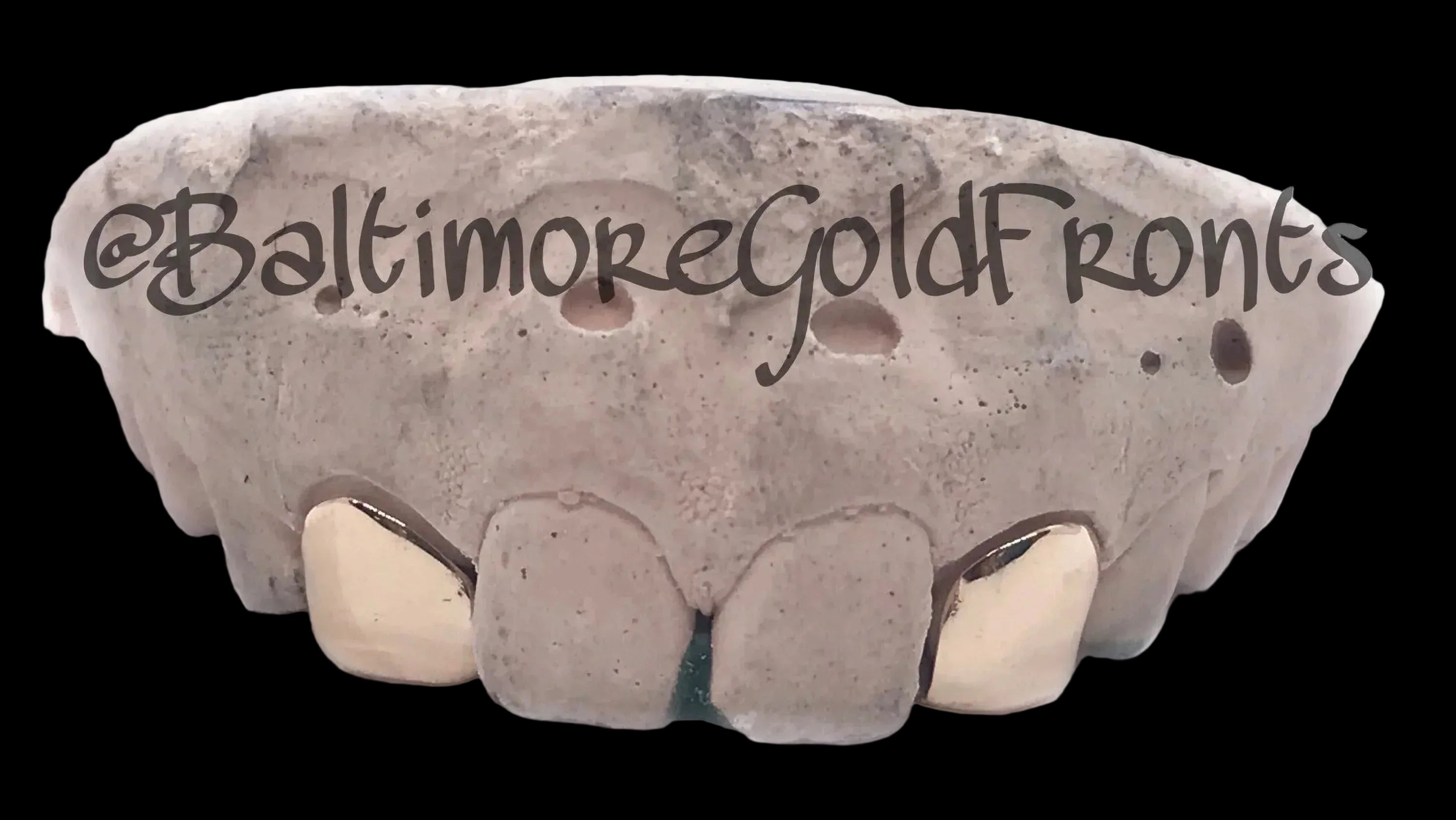 2 Gold Teeth: 2 Incisors And a Back Bridge image 0