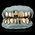 8 Gold Teeth: Top or Bottoms 10K-22K Gold image 1