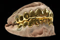 14k Gold 10 Top & 10 Bottom Plain Solid Set image 1
