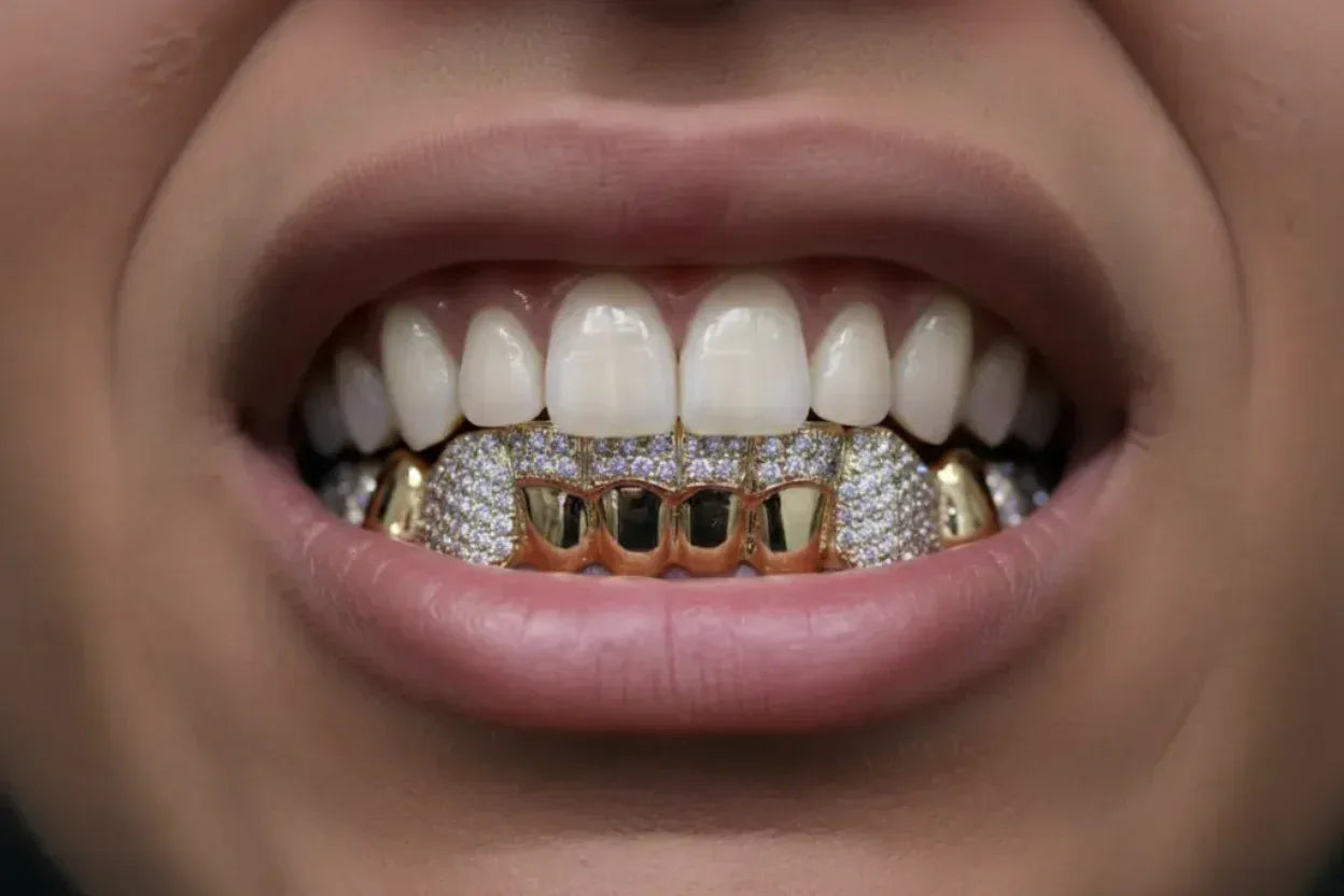 8 Gold Teeth: Stone Encrusted Piece Front Bar with K9's image 0