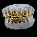 CYBER MONDAY 6 Gold Teeth: 10k Gold image 3
