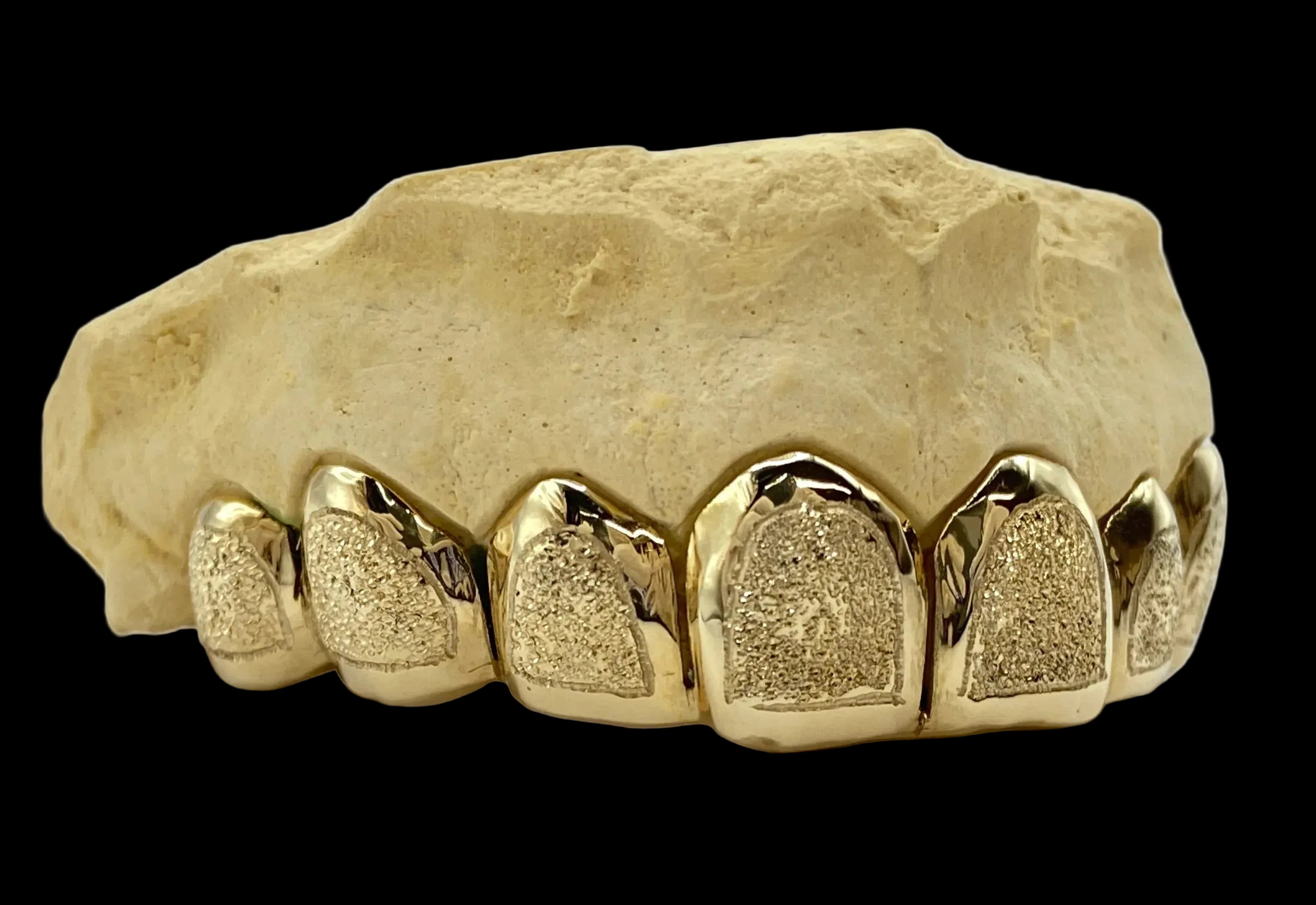 8 Gold Teeth: 10k Yellow Gold 8 Piece With Diamond Dust image 1